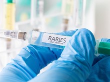 Mengapa Pasien yang Terinfeksi Rabies Takut Air? Begini Penjelasannya